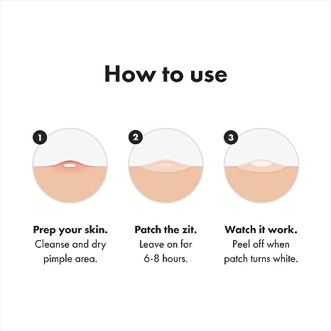 Mighty Patch Original from Hero Cosmetics - Hydrocolloid Acne Pimple Patch for Covering Zits and Blemishes, Spot Stickers for Face and Skin, Vegan-friendly and Not Tested on Animals (36 Count
