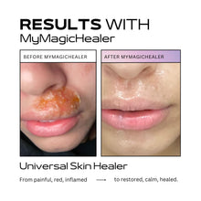 Load image into Gallery viewer, Beeswax &amp; Propolis Magic Salve | Universal Skin Healer | Boils | Abscesses | Hidradenitis Suppurativa | Anal Fissures | Wound Care | Healing For Painful, Irritated, Infected, Open, Dry &amp; Cracked Skin