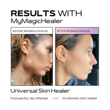 Load image into Gallery viewer, Beeswax &amp; Propolis Magic Salve | Universal Skin Healer | Boils | Abscesses | Hidradenitis Suppurativa | Anal Fissures | Wound Care | Healing For Painful, Irritated, Infected, Open, Dry &amp; Cracked Skin