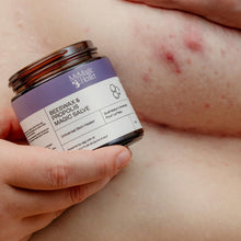 Load image into Gallery viewer, Beeswax &amp; Propolis Magic Salve | Universal Skin Healer | Boils | Abscesses | Hidradenitis Suppurativa | Anal Fissures | Wound Care | Healing For Painful, Irritated, Infected, Open, Dry &amp; Cracked Skin