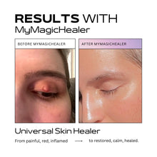 Load image into Gallery viewer, Beeswax &amp; Propolis Magic Salve | Universal Skin Healer | Boils | Abscesses | Hidradenitis Suppurativa | Anal Fissures | Wound Care | Healing For Painful, Irritated, Infected, Open, Dry &amp; Cracked Skin