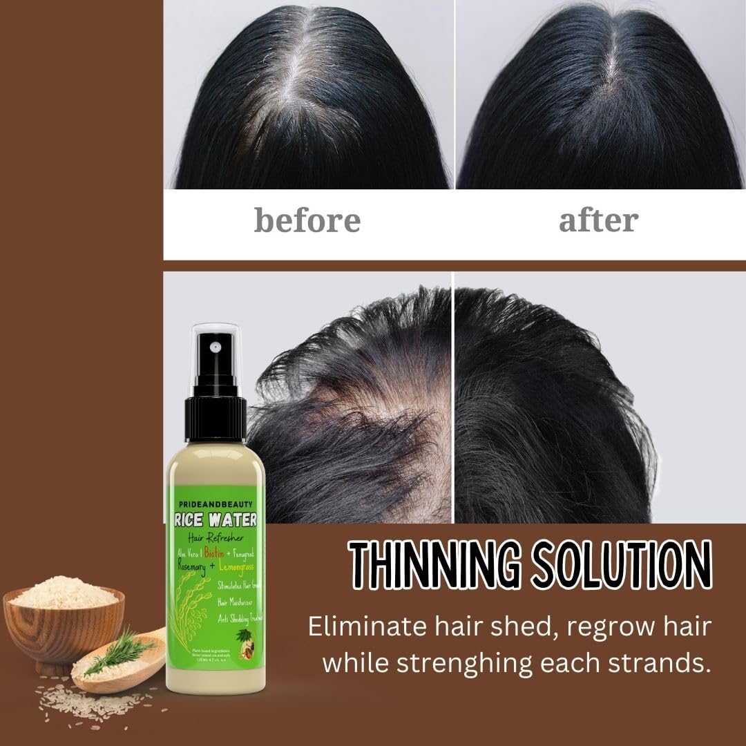 Rice Water For Hair Growth - Infused with Rosemary, Biotin, Vegan Non-Greasy Spray Naturally Thicker, Longer, Softer Hair, Men & Women Hair Spray (Rosemary + Lemongrass, 4 OUNCE)