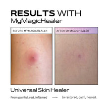 Load image into Gallery viewer, Beeswax &amp; Propolis Magic Salve | Universal Skin Healer | Boils | Abscesses | Hidradenitis Suppurativa | Anal Fissures | Wound Care | Healing For Painful, Irritated, Infected, Open, Dry &amp; Cracked Skin