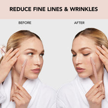 Load image into Gallery viewer, Kitsch Dermaplaning Tool - Face Razors for Women | Eyebrow Razor &amp; Face Shaver for Women | Facial Hair Removal for Women | Dermaplane Razor for Women Face, 12 pc (Terracotta)