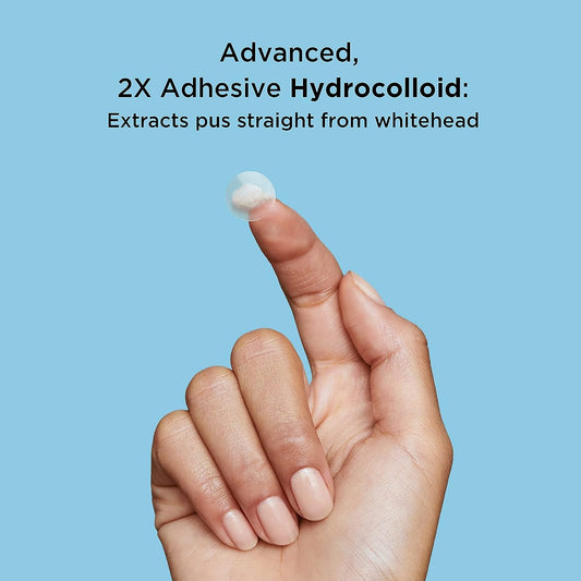 Avarelle Pimple Patches (40 Count) Hydrocolloid Acne Cover Patches | Zit Patches for Blemishes, Zits and Breakouts with Tea Tree, Calendula and Cica Oil for Face | Vegan, Cruelty Free Certified, Carbonfree Certified (40 PATCHES)